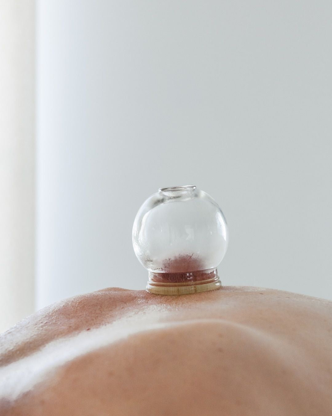 Cupping