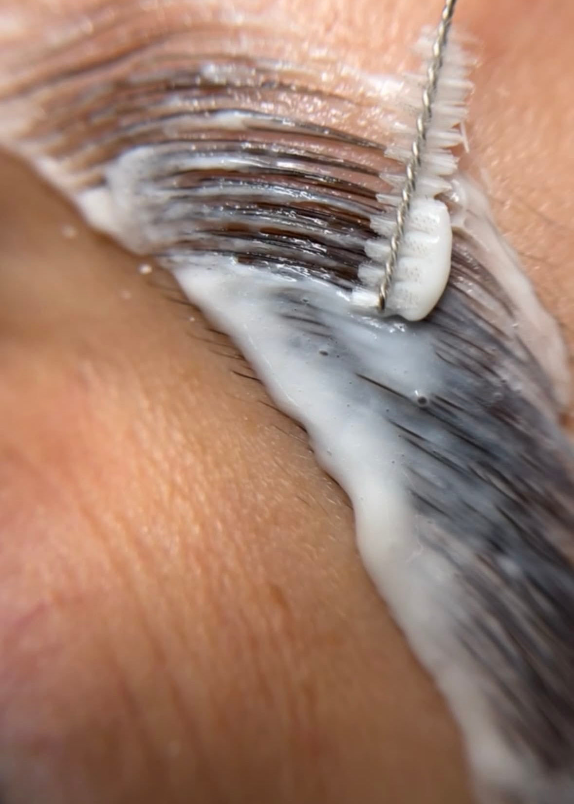 Browlift Rehaussement de sourcils